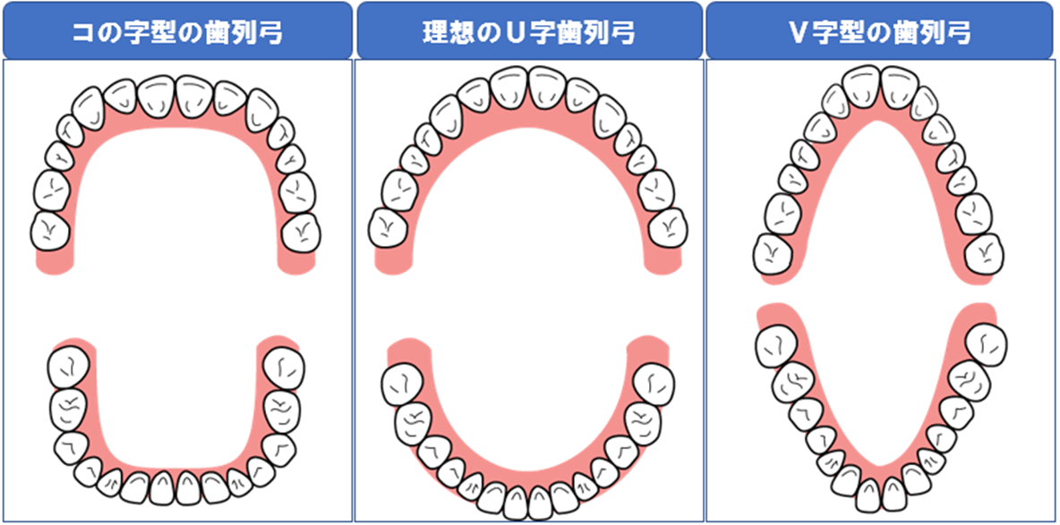 歯列弓の一覧画像