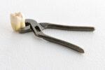 インビザラインは抜歯ありの治療もできる？抜歯が必要な症例や抜歯のタイミングを解説